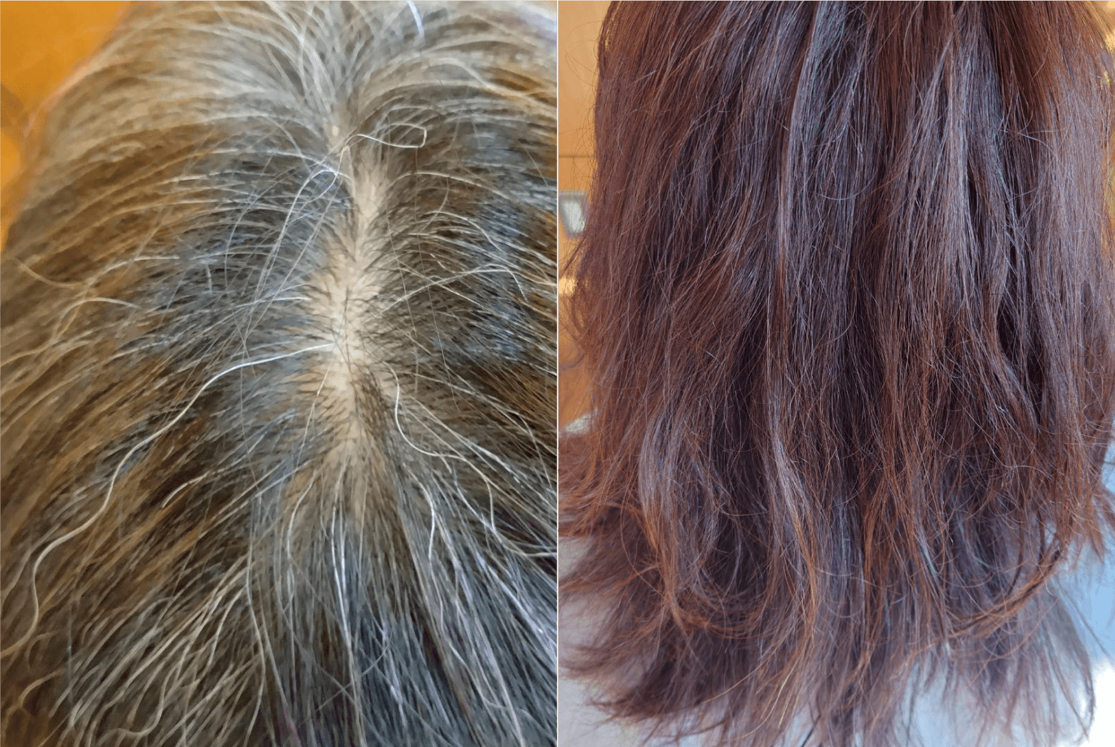 髪の病院セミナー